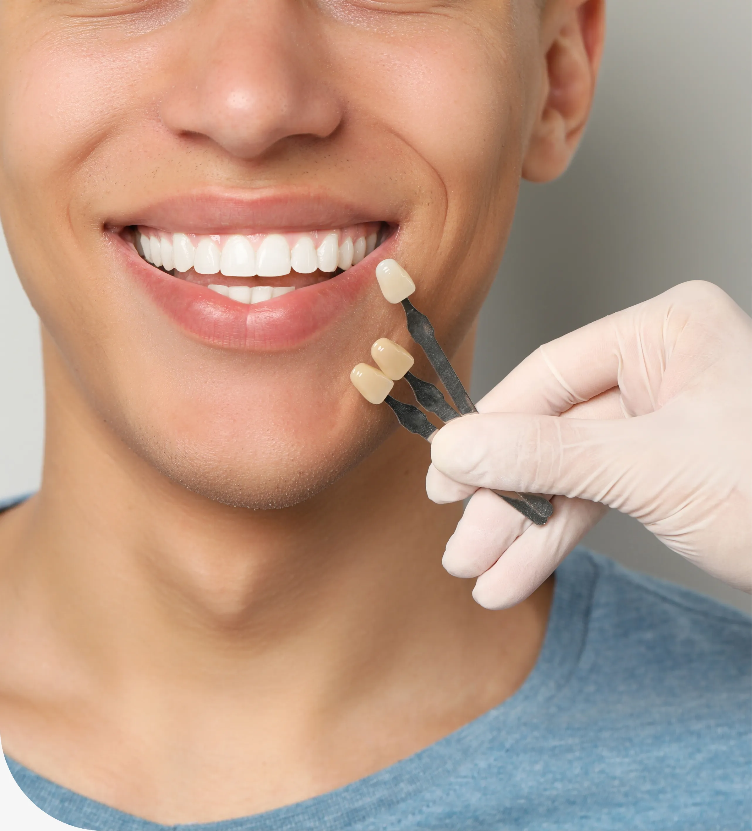 Dental Veneers in Chicago, IL