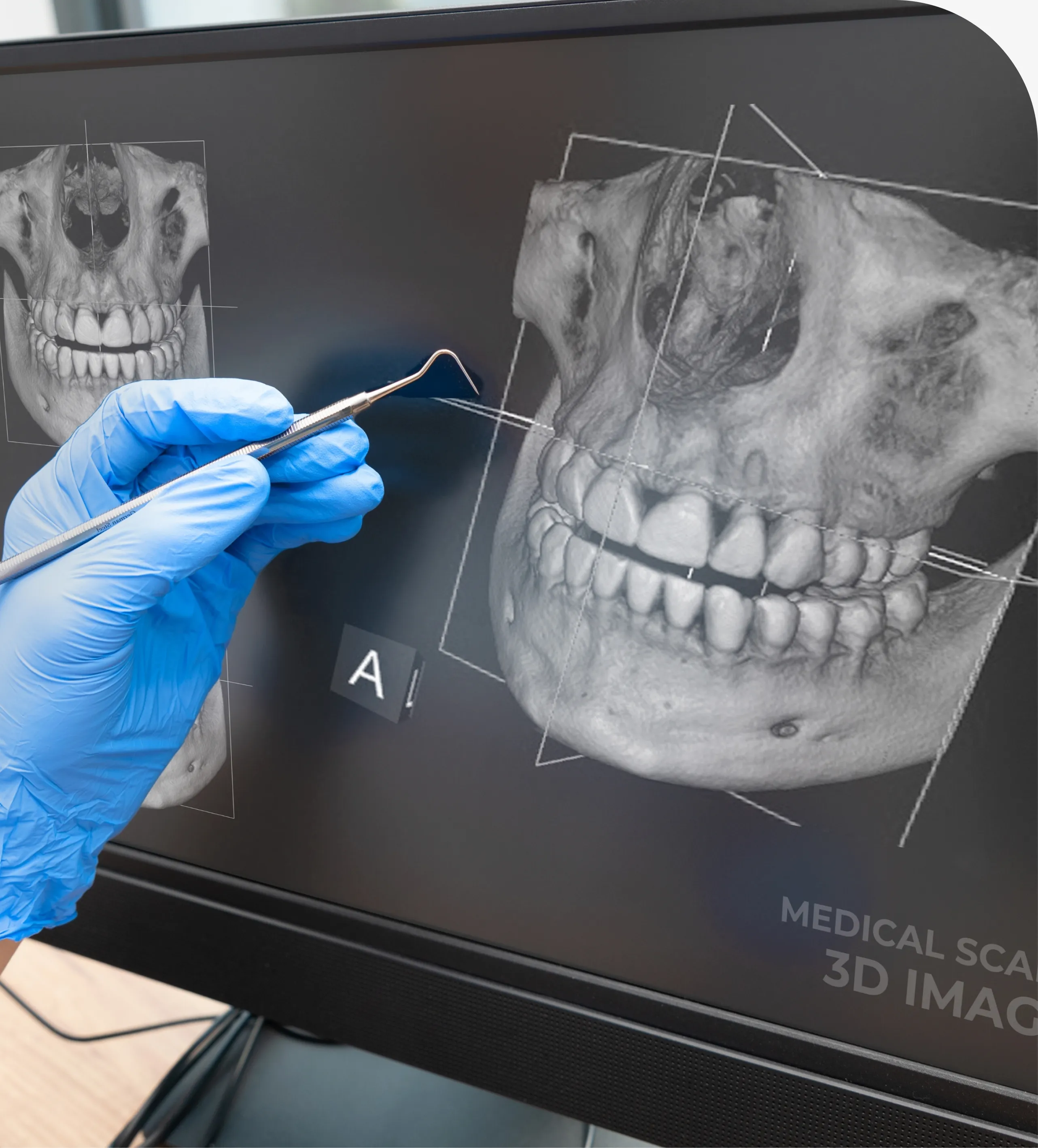 Digital X-Rays in Chicago, IL