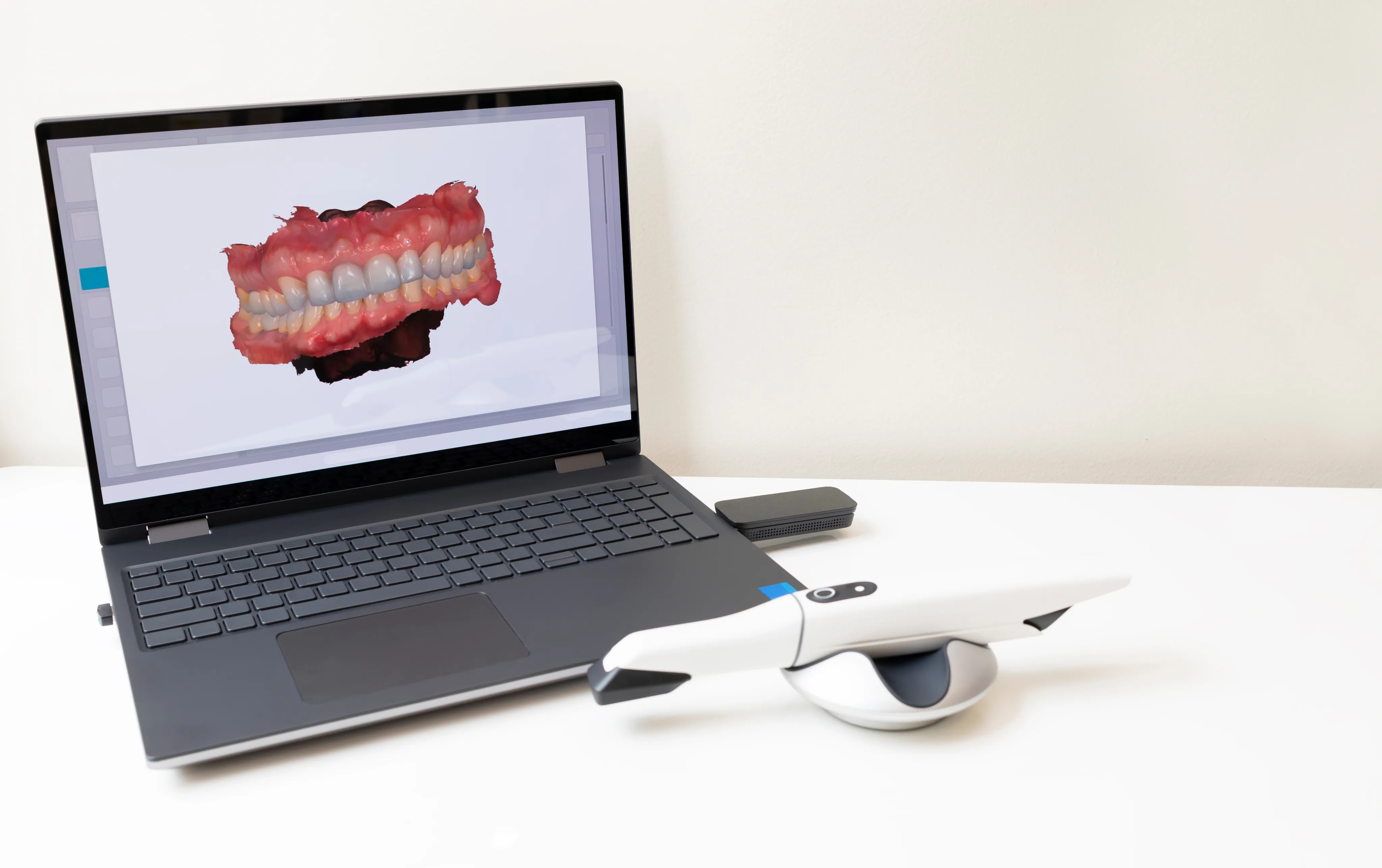Intraoral Cameras